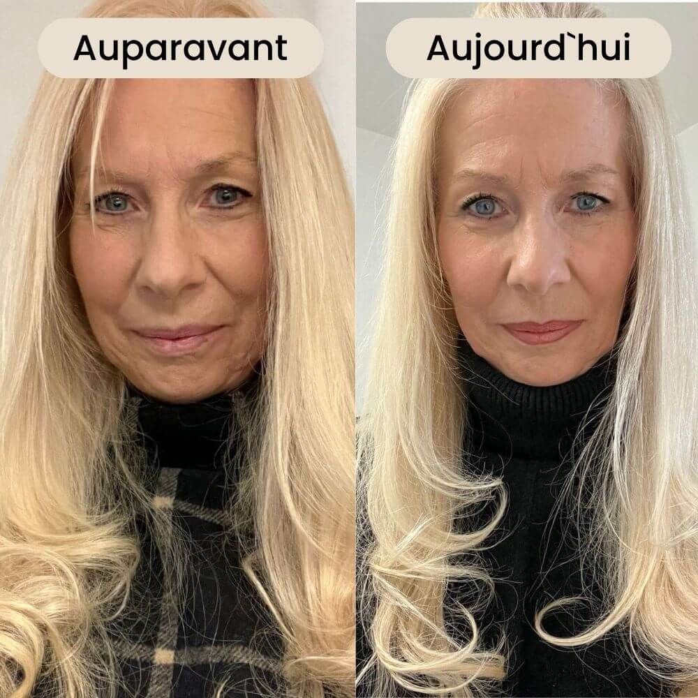 Afbeeldingsbeschrijving niet beschikbaar